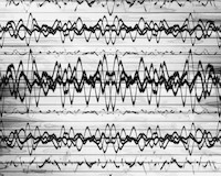 Zdroj: Isifa/Thinkstock